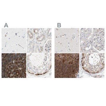 Anti-NFKB2 antibody produced in rabbit Prestige Antibodies&#174; Powered by Atlas Antibodies, affinity isolated antibody, buffered aqueous glycerol solution