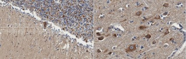 Anti-Alpha 2b Adrenergic Receptor from rabbit, purified by affinity chromatography