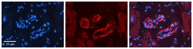 Anti-SPRY2 antibody produced in rabbit affinity isolated antibody