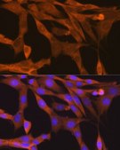 Anti-TBK1/NAK antibody produced in rabbit