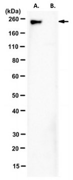 Anti-SMCHD1 Antibody, clone 2B8