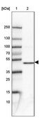 Anti-PPME1 antibody produced in rabbit Prestige Antibodies® Powered by Atlas Antibodies, affinity isolated antibody, buffered aqueous glycerol solution