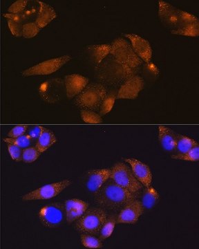 Anti- CDK4 antibody produced in rabbit