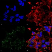 Monoclonal Anti-Copper Transporting Atpase 2 - Atto 594 antibody produced in mouse clone S62-29, purified immunoglobulin