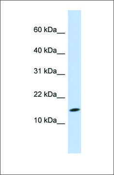 Anti-UBE2D3 antibody produced in rabbit affinity isolated antibody