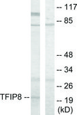 Anti-TFIP8 antibody produced in rabbit affinity isolated antibody