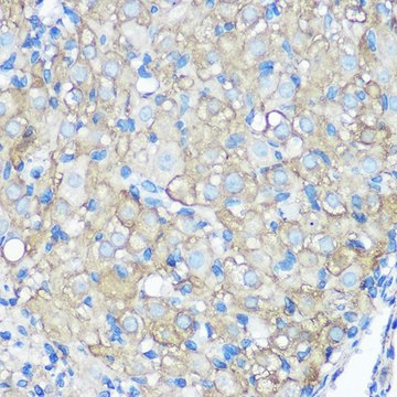 Anti-CD23 antibody produced in rabbit