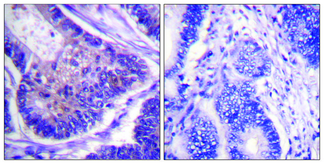 Anti-EIF4B antibody produced in rabbit affinity isolated antibody