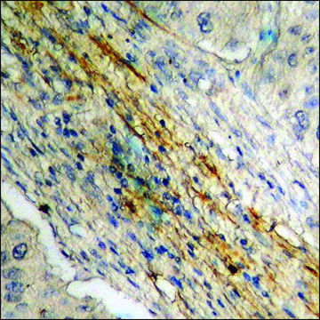 Anti-phospho-Caldesmon (pSer789) antibody produced in rabbit affinity isolated antibody