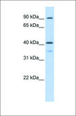 Anti-OAS1 (ab3) antibody produced in rabbit affinity isolated antibody