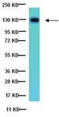 Anti-Focal Adhesion Kinase Antibody, clone BLAb2H7 clone BLAb2H7, from mouse