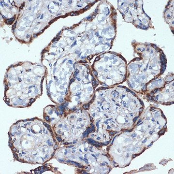 Anti-P4HB antibody produced in rabbit