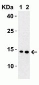 Anti-SARS-CoV-2 (COVID-19) Membrane antibody produced in rabbit affinity isolated antibody