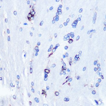 Anti-YB-1/YBX1 antibody produced in rabbit