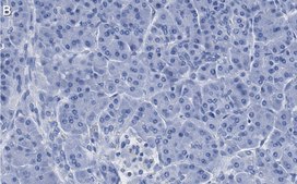 Anti-ISL-1 Antibody, clone 1B11 ZooMAb® Rabbit Monoclonal recombinant, expressed in HEK 293 cells