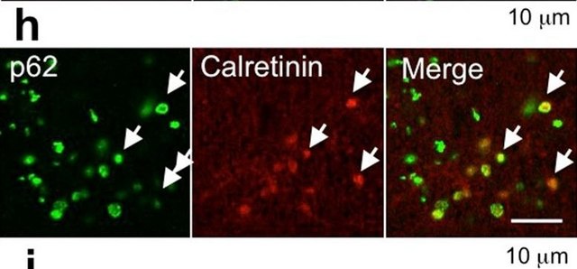 Anti-Calretinin Antibody, clone 6B8.2 clone 6B8.2, Chemicon&#174;, from mouse