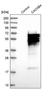 Anti-CACNB4 antibody produced in rabbit Prestige Antibodies&#174; Powered by Atlas Antibodies, affinity isolated antibody, buffered aqueous glycerol solution