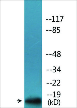 抗 磷酸-p16-INK4a (pSer 152 ) 兔抗 affinity isolated antibody