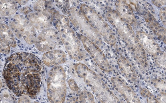 Anti-NOTCH2 Antibody, clone 1B14-5 ZooMAb&#174; Rabbit Monoclonal recombinant, expressed in HEK 293 cells