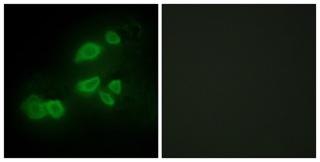 Anti-CDCP1 antibody produced in rabbit affinity isolated antibody