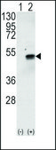 Anti-ADCK1 (N-term) antibody produced in rabbit IgG fraction of antiserum, buffered aqueous solution