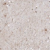 Anti-ETAA1 antibody produced in rabbit Prestige Antibodies® Powered by Atlas Antibodies, affinity isolated antibody, buffered aqueous glycerol solution