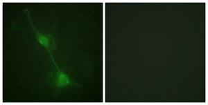 Anti-Ataxin 1, C-Terminal antibody produced in rabbit affinity isolated antibody