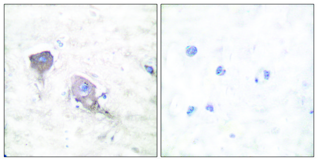 Anti-SNAP25 antibody produced in rabbit affinity isolated antibody