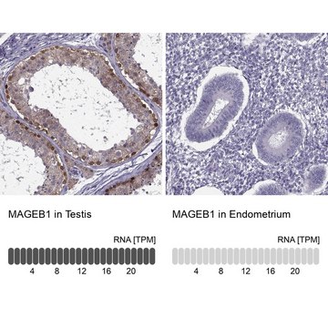 ANTI-MAGEB1 antibody produced in rabbit Prestige Antibodies&#174; Powered by Atlas Antibodies, affinity isolated antibody, buffered aqueous glycerol solution