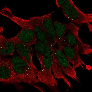 Anti-WNT2B antibody produced in rabbit Prestige Antibodies&#174; Powered by Atlas Antibodies, affinity isolated antibody