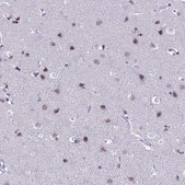 Anti-BCL7A antibody produced in rabbit Prestige Antibodies® Powered by Atlas Antibodies, affinity isolated antibody, buffered aqueous glycerol solution