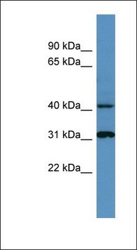 Anti-CTSD antibody produced in rabbit affinity isolated antibody