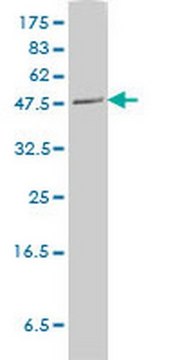 Anti-PLTP Mouse mAb (2F3-G4) liquid, clone 2F3-G4, Calbiochem&#174;