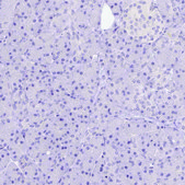 Anti-CACNA1A antibody produced in rabbit Prestige Antibodies® Powered by Atlas Antibodies, affinity isolated antibody, buffered aqueous glycerol solution