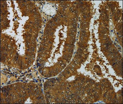 Anti-TAB1 antibody produced in rabbit affinity isolated antibody