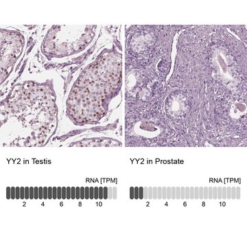 Anti-YY2 antibody produced in rabbit Prestige Antibodies&#174; Powered by Atlas Antibodies, affinity isolated antibody