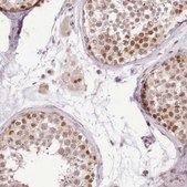 Anti-UBXN7 antibody produced in rabbit Prestige Antibodies® Powered by Atlas Antibodies, affinity isolated antibody, buffered aqueous glycerol solution