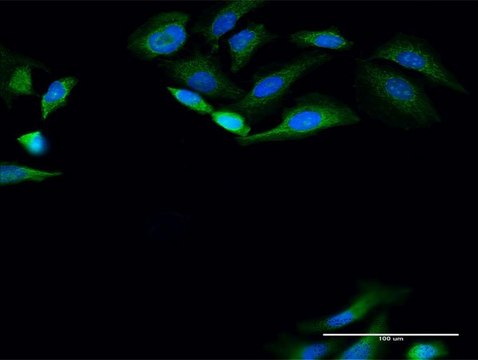 Anti-PANK4 antibody produced in rabbit purified immunoglobulin, buffered aqueous solution