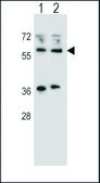 ANTI-WTIP (C-TERM) antibody produced in rabbit IgG fraction of antiserum, buffered aqueous solution