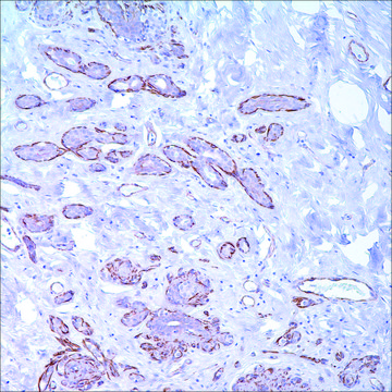 Caldesmon (E89) Rabbit Monoclonal Primary Antibody