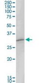 Anti-MAGEA8 antibody produced in rabbit purified immunoglobulin, buffered aqueous solution