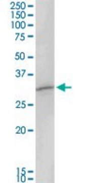 Anti-MAGEA8 antibody produced in rabbit purified immunoglobulin, buffered aqueous solution