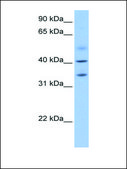 Anti-ZC3H14 antibody produced in rabbit affinity isolated antibody