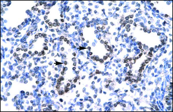 Anti-HEY1 antibody produced in rabbit IgG fraction of antiserum