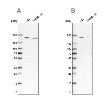 抗-SMARCC2 兔抗 affinity isolated antibody, buffered aqueous glycerol solution