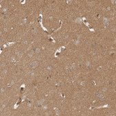 Anti-OTUD6B antibody produced in rabbit Prestige Antibodies® Powered by Atlas Antibodies, affinity isolated antibody, buffered aqueous glycerol solution