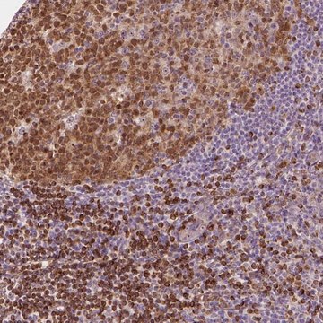 Anti-SMC2 antibody produced in rabbit Prestige Antibodies&#174; Powered by Atlas Antibodies, affinity isolated antibody, buffered aqueous glycerol solution