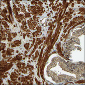 Anti-SPHK1 antibody produced in rabbit Prestige Antibodies® Powered by Atlas Antibodies, affinity isolated antibody, buffered aqueous glycerol solution