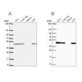 Anti-NDUFS2 antibody produced in rabbit Prestige Antibodies® Powered by Atlas Antibodies, affinity isolated antibody, buffered aqueous glycerol solution