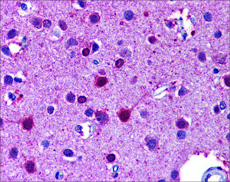 Anti-RARB antibody produced in rabbit affinity isolated antibody